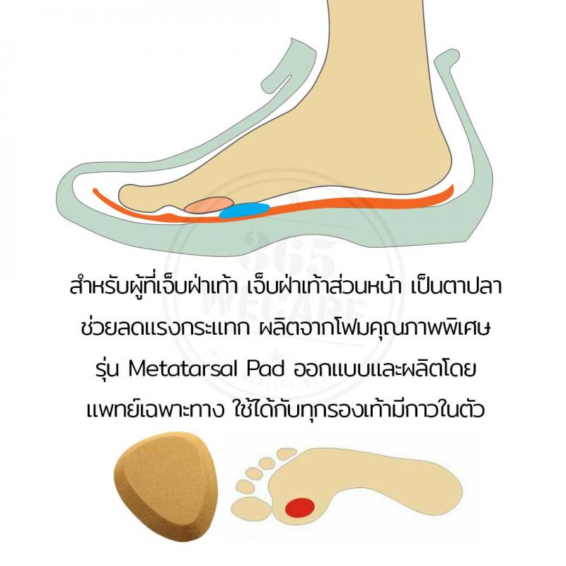 Archimed Metatarsal Pad Size L อาร์คิเมด