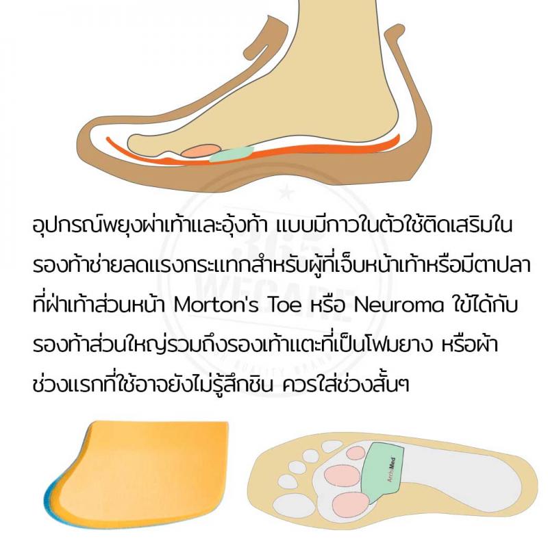 Archimed Poron Metatarsal Bar Size S อาร์คิเมด