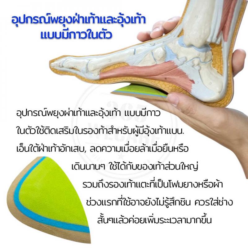 Archimed Arch Support Size S อาร์คิเมด