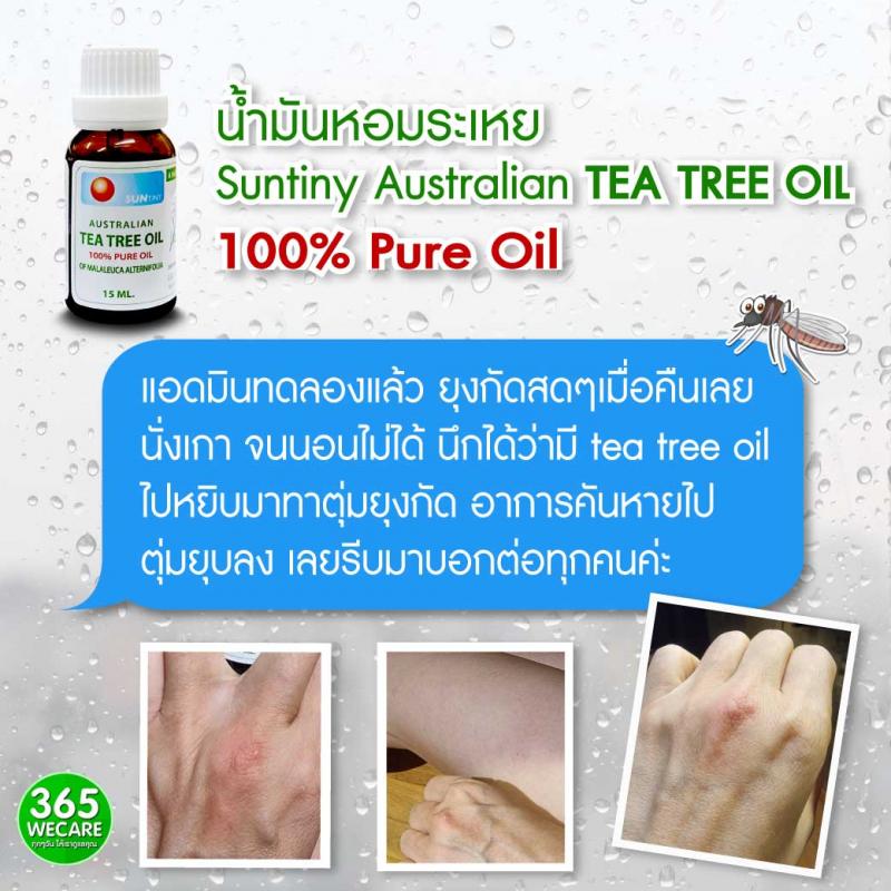 Suntiny Australian TEA TREE OIL 15 ml. ซันตินี่ 