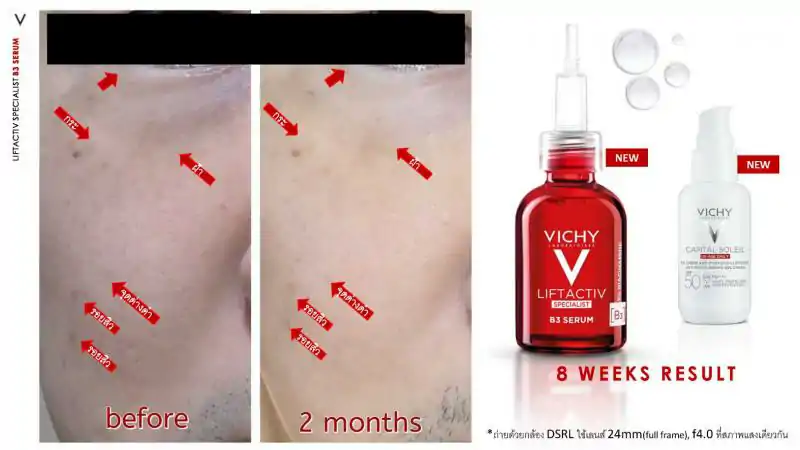 VICHY Liftactiv B3 Dark Spots Serum 30 ml. วิชี่ ลิฟแอ็คทีฟ บีทรี ดาร์ค สปอต เซรั่ม 30มล.