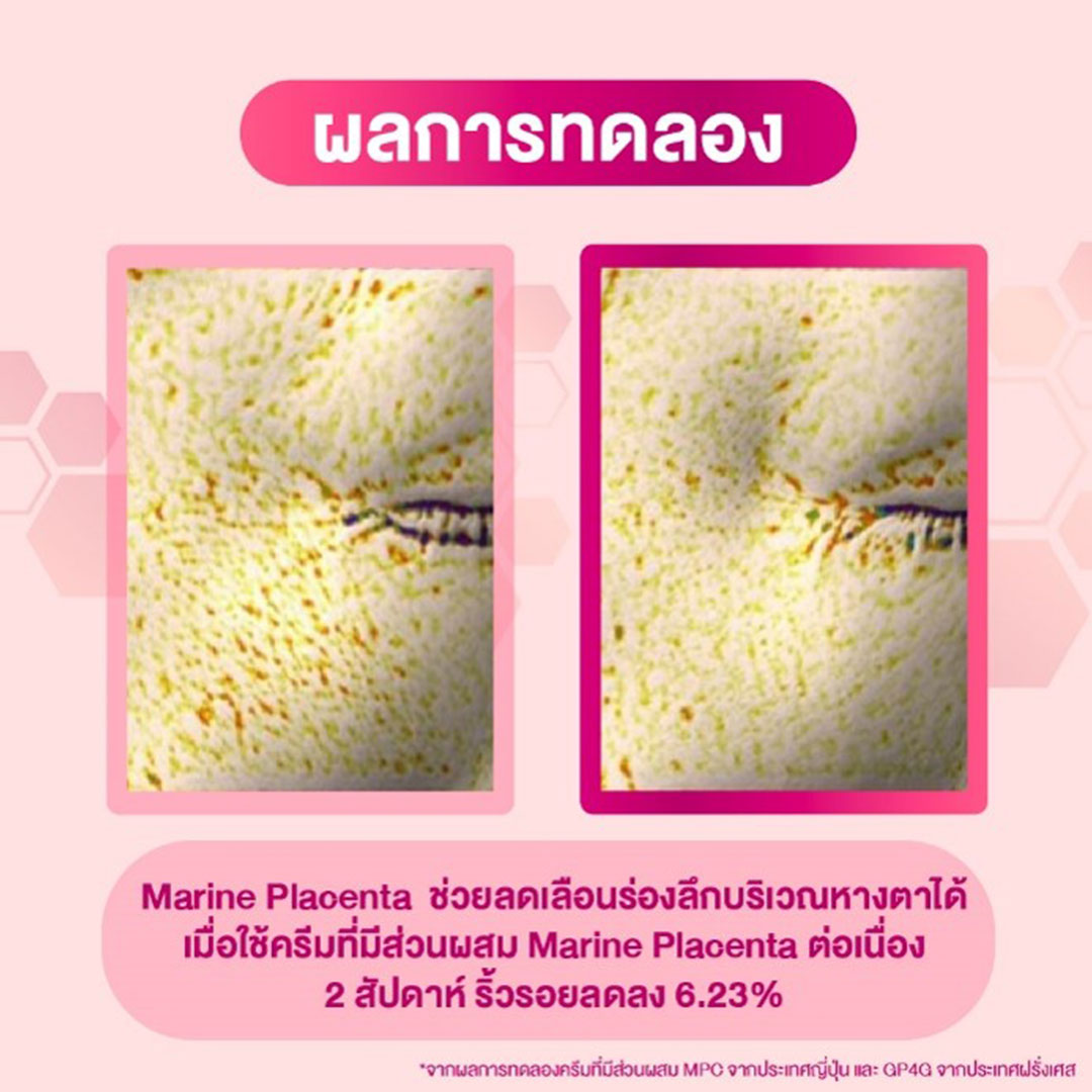 Oilatum Intense Hydrating Essence 30g ออยลาตุ้ม อินเทนส์ ไฮเดรติ้ง เอสเซนส์