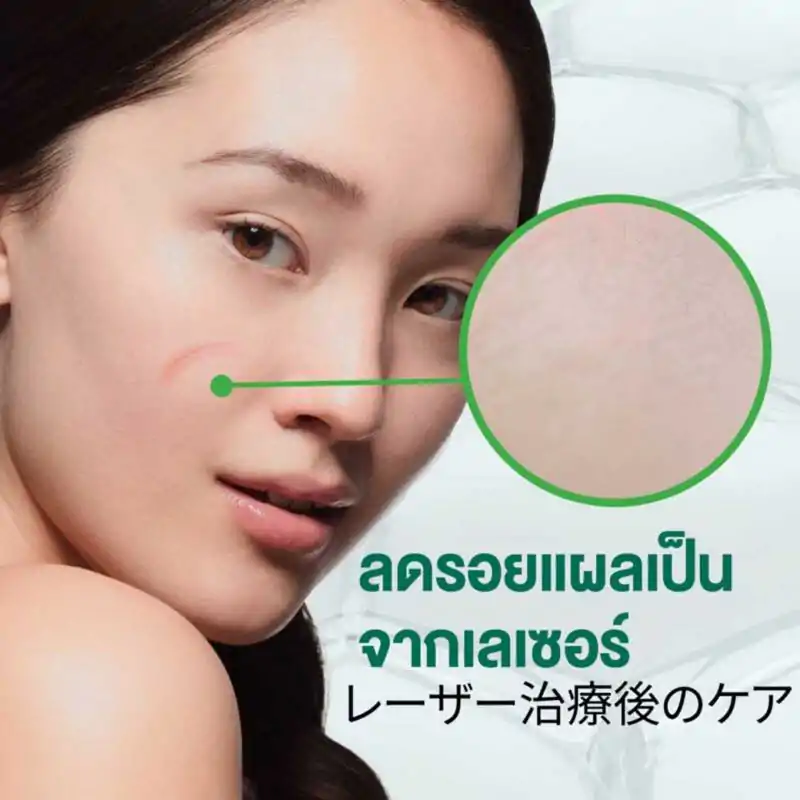SMOOTH-E Cream สมูทอี ครีม