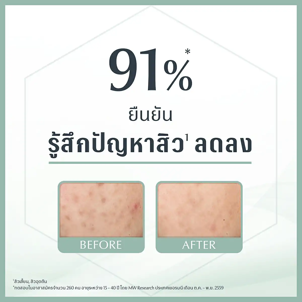 Eucerin Pro Acne Solution A.I. Matt Fluid 50 ml. ยูเซอรีน โปร แอคเน่ โซลูชั่น เอ.ไอ.แมท ฟลูอิค 50มล.