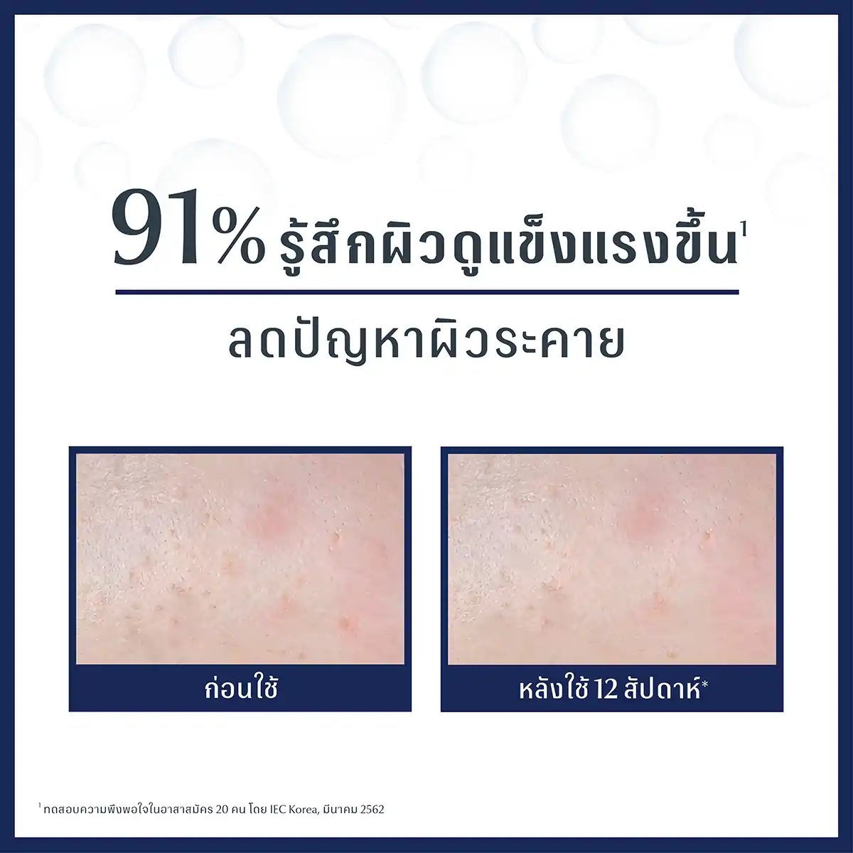 EUCERIN Ultra Sensitive Repair Gel Cream 50 ml. ยูเซอริน อัลตร้า เซนซิทีฟ รีแพร์ เจล ครีม 50มล.