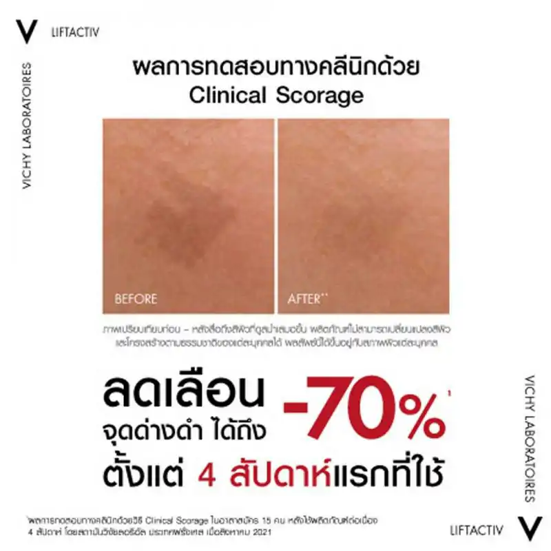 VICHY Liftactiv B3 Dark Spots Serum 30 ml. วิชี่ ลิฟแอ็คทีฟ บีทรี ดาร์ค สปอต เซรั่ม 30มล.