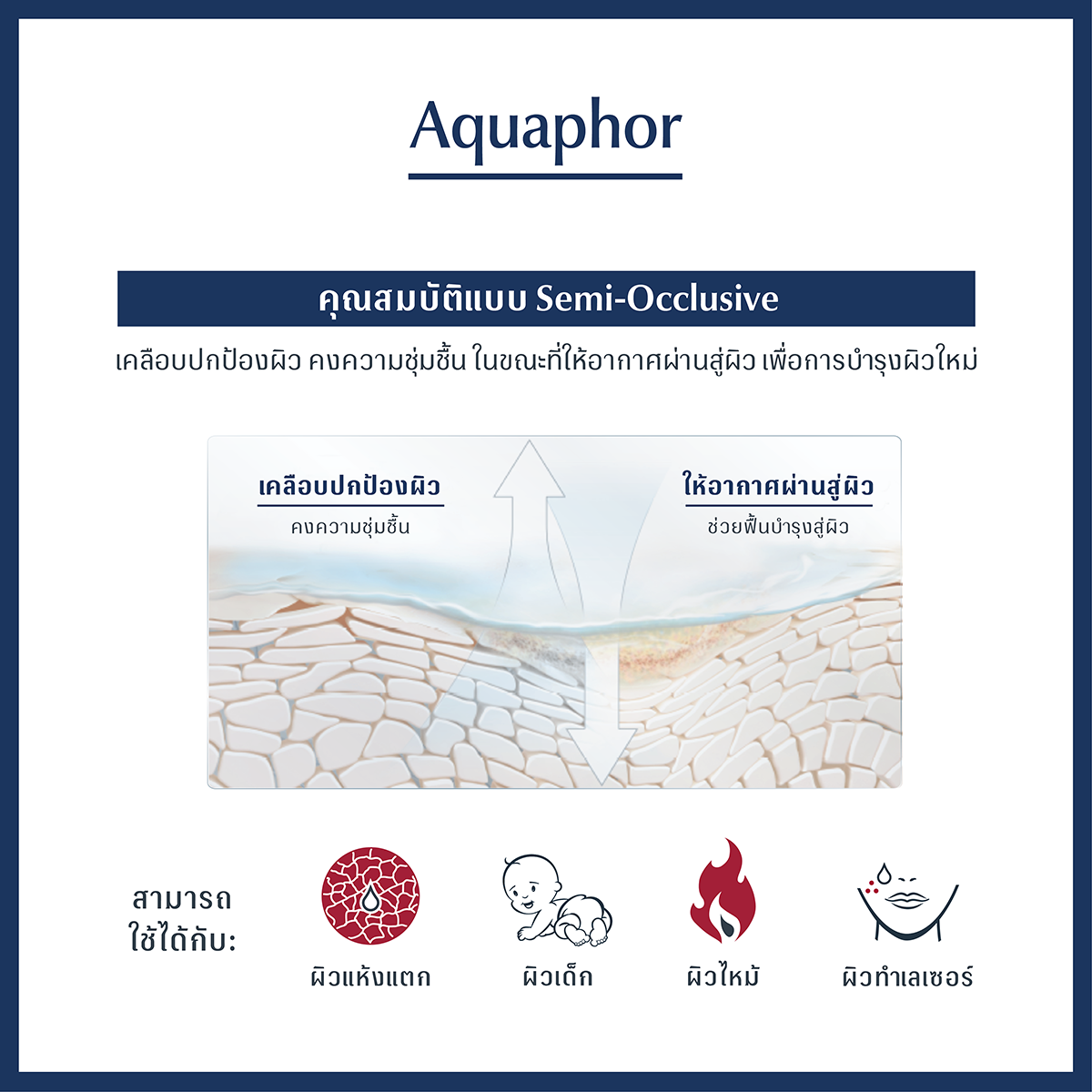 Eucerin Aquaphor Sos Lip Care 10ml. ยูเซอริน อควาฟอร์ เอสโอเอส ลิป แคร์